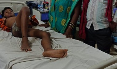 जंगीपुर बिजली विभाग की घोर लापरवाही से झुलसा बालक